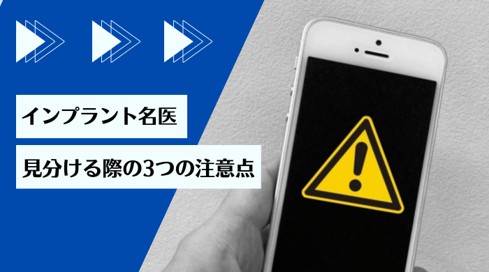 インプラント名医を見分ける際の2つの注意点