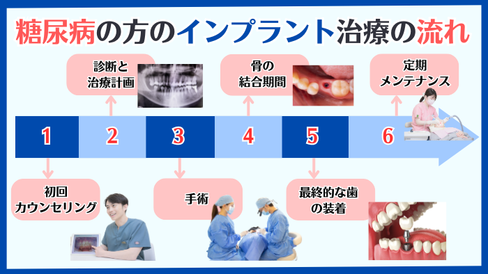 糖尿病患者様のインプラント治療：流れや注意点