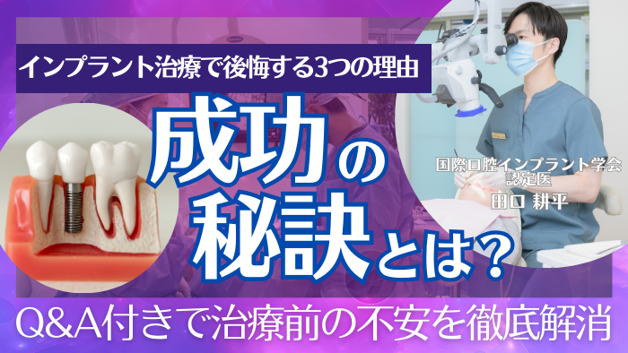 インプラントで後悔する3つの理由！成功させる秘訣とは？【Q&A付き】