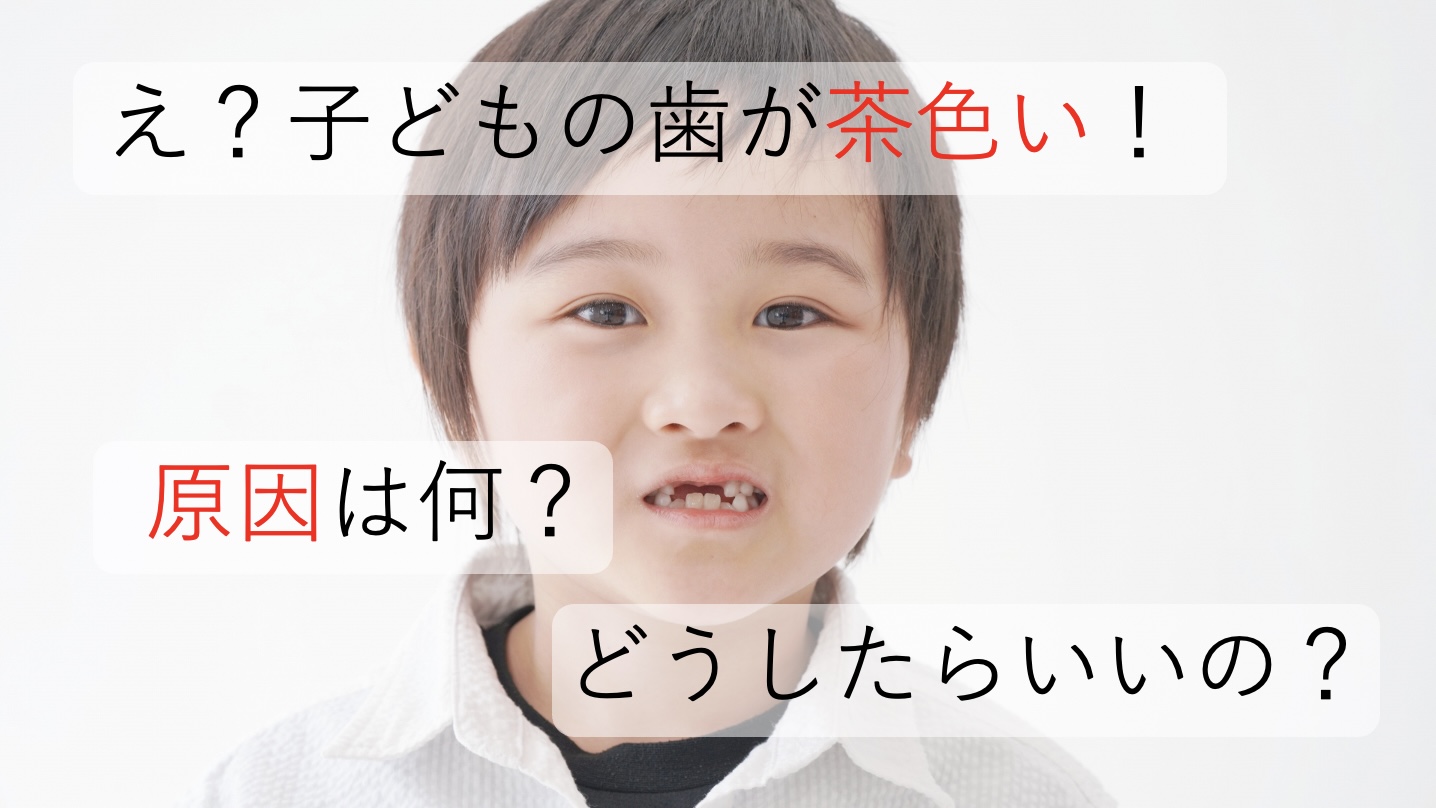 子どもの歯が茶色い 4つの原因と対処法を歯医者さんが解説します 北戸田coco歯科 戸田市 北戸田市の歯医者