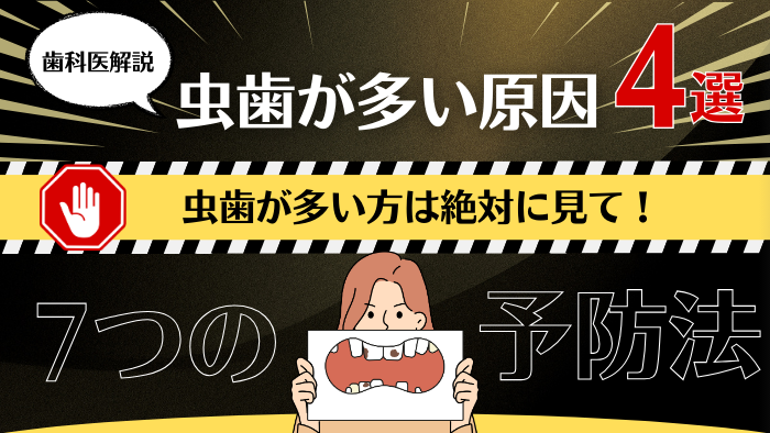 虫歯が多いあなたへ！4つの原因と7つの予防法を徹底解説【歯科医監修】