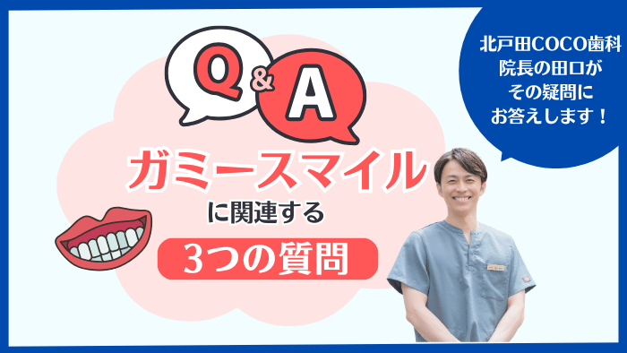 ガミースマイル治療に関するよくある質問3選